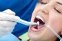 Root Canal Therapy in Toronto - Roseland Dental