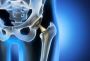 Hip Fracture treatment in gurgaon