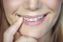 Expert Wisdom Teeth Removal in Santa Paula