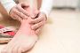 5 precautions to take during sprained ankle treatment 