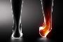 Which treatment follows after sprained ankle ?