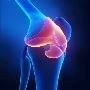 Knee replacement Singapore / 5 Causes of Knee replacement 