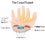 Carpal tunnel symptoms | 5 Carpal tunnel treatment 