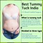 Best Tummy Tuck Surgeon