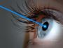 Best Laser Eye Surgery