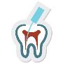 Root canal treatment service provider in kukatpally hyderaba
