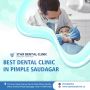 Best Dental Clinic In Pimple Saudagar - Star Dental Clinic