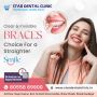 Braces Specialist in Pimple Saudagar | Star Dental Clinic