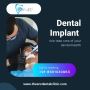 Best Dental Implant in Jaipur-The ARC Dental Clinic
