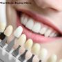 Teeth Whitening Treatment in Noida