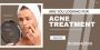 Acne Treatment in Ludhiana