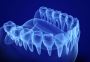 Are Full Dentures the Right Solution for You?
