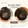 Get Effective Hair Fall PRP Treatment 