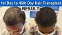 hair treatment clinic in chennai