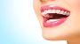 5 Benefits of tooth implant