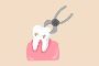 5 Ways to alleviate extraction of wisdom tooth 