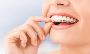 5 Advantages of invisalign clear aligners