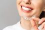 7 Reason behind about invisalign clear aligners