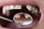 5 Risk Factors of Dental Implants