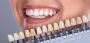Cosmetic Dentistry In Chicago