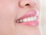 Reveal Your Brightest Smile With Teeth Whitening in Vaughan