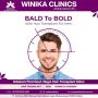 Best Hair Transplant Doctors In Winika Clinics