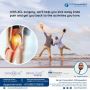 Expert Guide to ACL Reconstruction Surgery