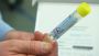 247labkit’s Quick STD Test Kit 247labkit’s Quick STD Test Kit