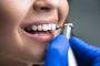 Dental Cleaning Columbia
