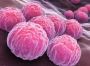 Chlamydia: Causes, Symptoms, Treatment & Prevention | ASP He