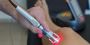 Cold Laser Therapy in Murfreesboro– Fast, Non-Invasive