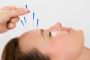 Headaches Acupuncture Middle Tennessee – Natural Healing