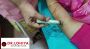 Acupuncture courses in Delhi & Mumbai