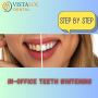 In-Office Teeth Whitening: Step Guide