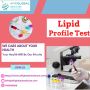 Lipid Profile Test in Nigeria