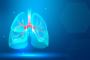 Best Lung Surgery in Mumbai, Navi Mumbai | DR Nikhil Rane