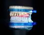  The Role of CAD CAM in Dental Implants 