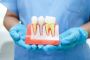 Why Dental Implants Are the Best Solution for Missing Teeth