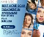 Best Acne Scar Treatment in Hyderabad – Transform Your Skin 