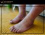 How to Help Circulation in Legs