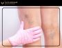How to remove dark patches on legs?