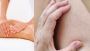 What to Expect After Radiofrequency Ablation for Varicose