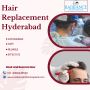 Hair Loss Treatment & Replacement in Hyderabad