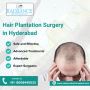 Affordable Hair Plantation Surgery in Hyderabad