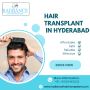Best Hair Transplant Clinic in Hyderabad for Men & Women
