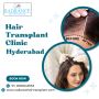 Expert Hair Transplant in Hyderabad | Safe & Advanced Techni