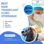 Best Hair Transplant Clinic Hyderabad