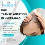 Affordable Hair Transplantation in Hyderabad