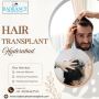 Reliable Hair Transplant Surgery in Hyderabad 
