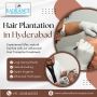 Affordable Hair Plantation in Hyderabad 